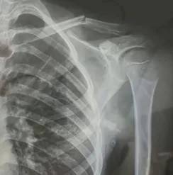 赤峰市教育局介入<strong></p>
<p>虚拟币JT</strong>，家长称：孩子拨弄开关被另一班班主任打伤