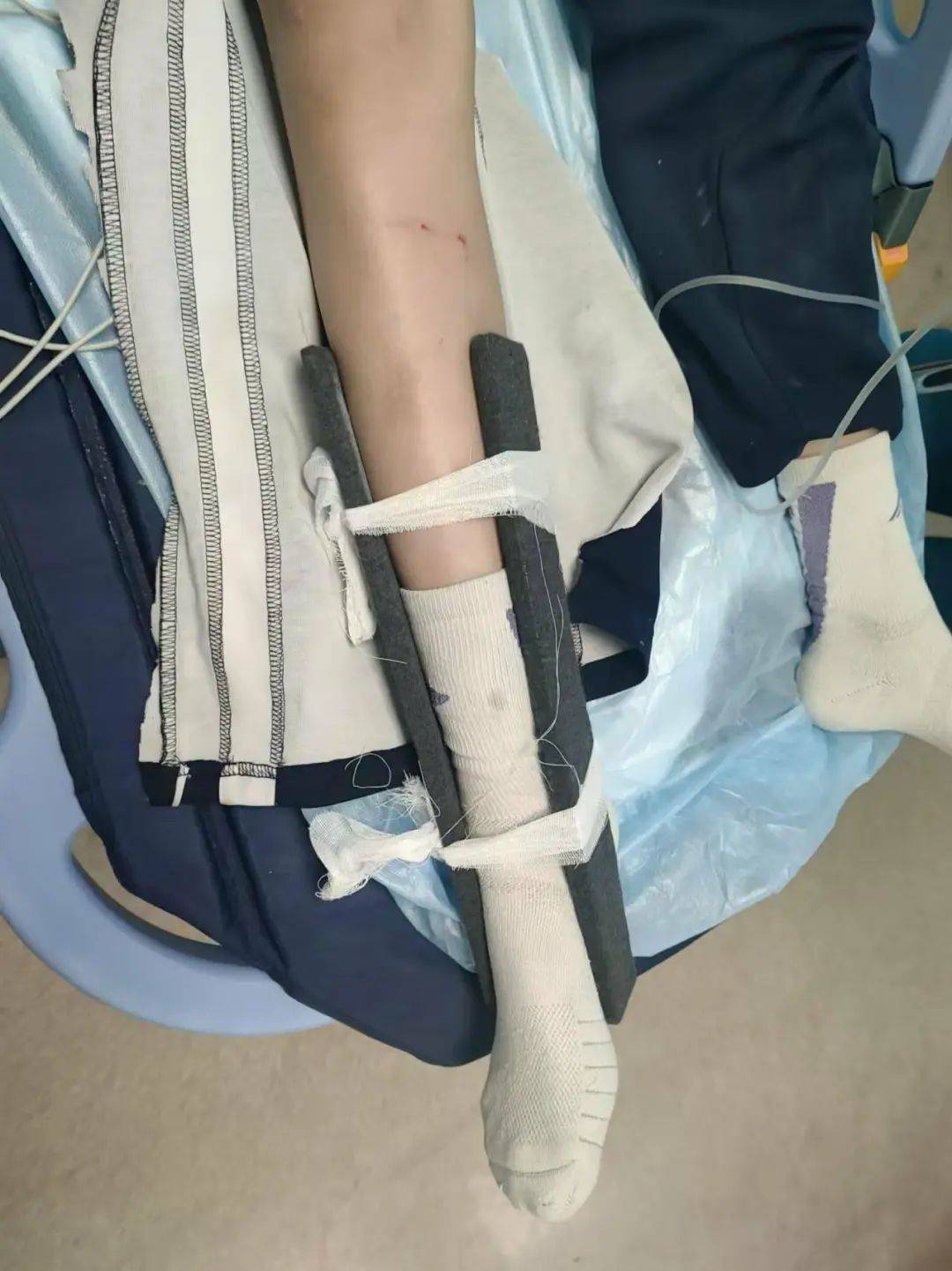 惨痛<strong></p>
<p>市场虚拟币</strong>！一人身亡！深圳多名学生骑电动车发生意外