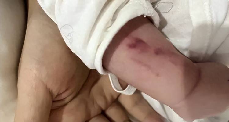 广西一男婴在月子中心被照料20天：身上2处骨折<strong></p>
<p>水果虚拟币</strong>，育婴室监控无法查看