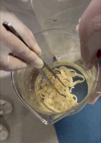 女子体内排出10米长绦虫<strong></p>
<p>虚拟币建群</strong>!原是两年前旅游时吃了这种食物