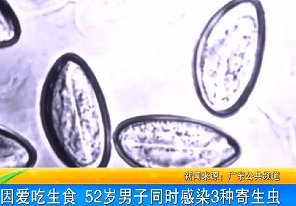 女子体内排出10米长绦虫<strong></p>
<p>虚拟币建群</strong>!原是两年前旅游时吃了这种食物