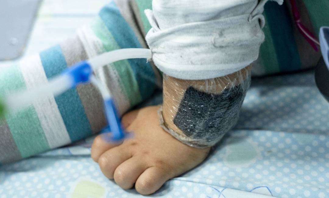 可瞬间产生近100℃高温<strong></p>
<p>虚拟币 狗币</strong>!合肥医生发出提醒