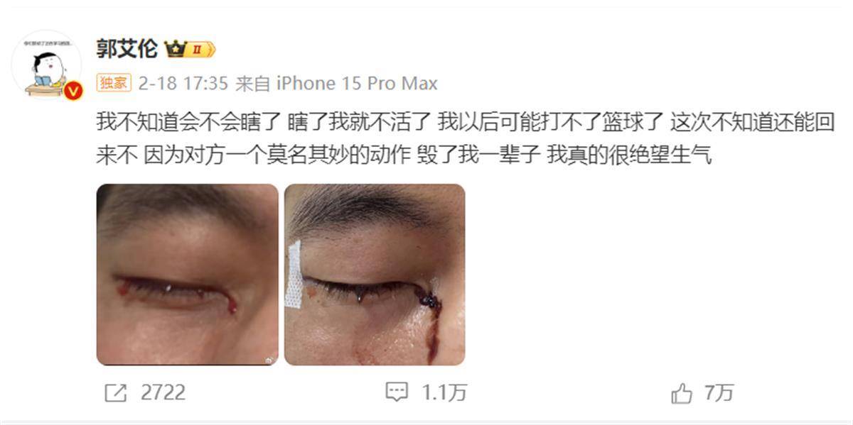 郭艾伦发文报平安:已顺利拆线<strong></p>
<p>虚拟币 狗币</strong>,相信一定会重回球场