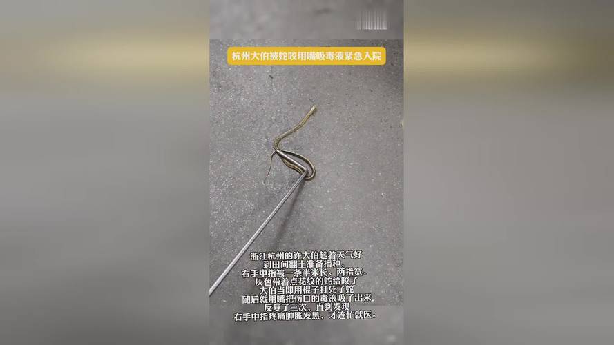 杭州大伯野外被蛇咬<strong></p>
<p>虚拟币挖矿</strong>，用嘴吸毒液后紧急入院的惊险事件