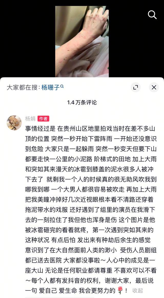 女演员贵州拍戏遇极端天气<strong></p>
<p>虚拟币 ICO</strong>,被冰雹砸伤!剧组伤员已送医