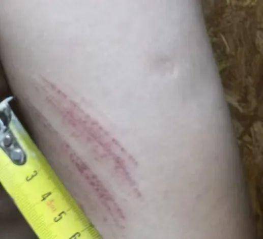 侄女与姑姑争祖父留下的门面<strong></p>
<p>虚拟马币</strong>，长沙租客“躺枪”：我被打了，店也被锁了！