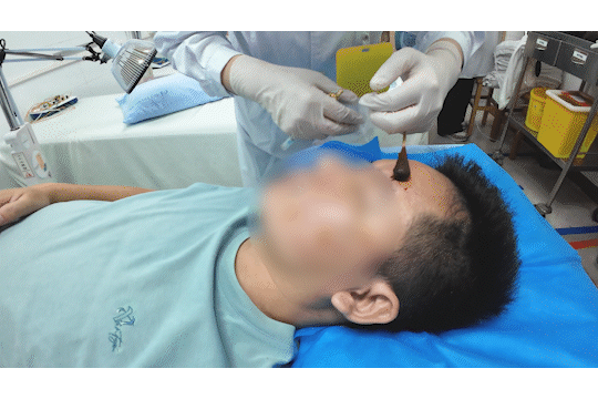 醒来“天塌了”<strong></p>
<p>虚拟币</strong>!深圳一女子眼睛闭不上、嘴巴漏水!这些错误很多人会犯