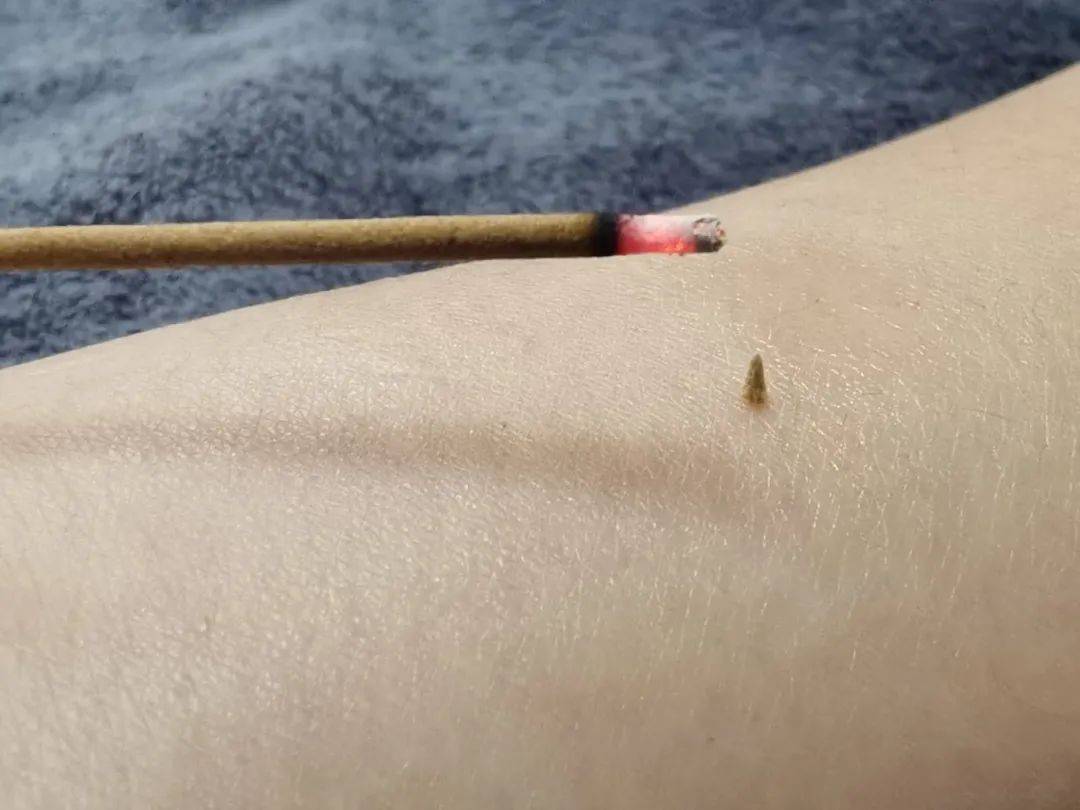 醒来“天塌了”<strong></p>
<p>虚拟币</strong>!深圳一女子眼睛闭不上、嘴巴漏水!这些错误很多人会犯