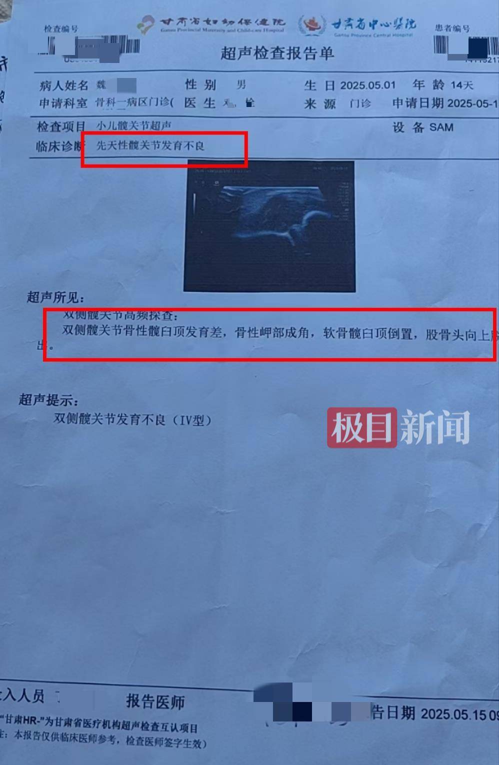 二胎出生查出先天性病症或落下残疾<strong></p>
<p>虚拟货币世界币</strong>,残疾父母称医院产检漏检、未尽告知义务,医院及医调委回应