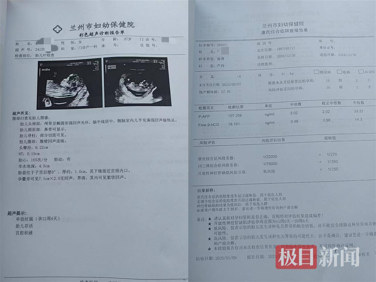 二胎出生查出先天性病症或落下残疾<strong></p>
<p>虚拟货币世界币</strong>,残疾父母称医院产检漏检、未尽告知义务,医院及医调委回应