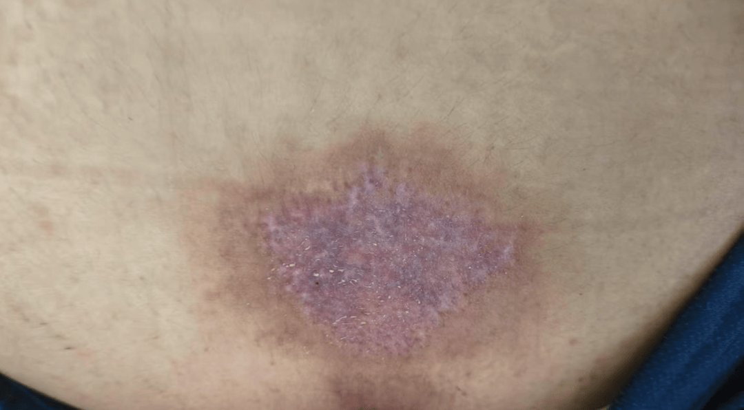 14岁女孩在拓展营遭体罚去世<strong></p>
<p>虚拟币 赚</strong>,班主任因截留其给父母信件受审