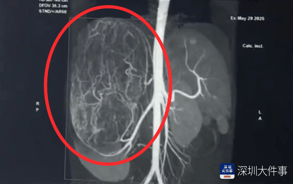 店员试衣间里一句警告<strong></p>
<p>银行虚拟币</strong>,竟救了17岁少女!一家人火速赶到深圳