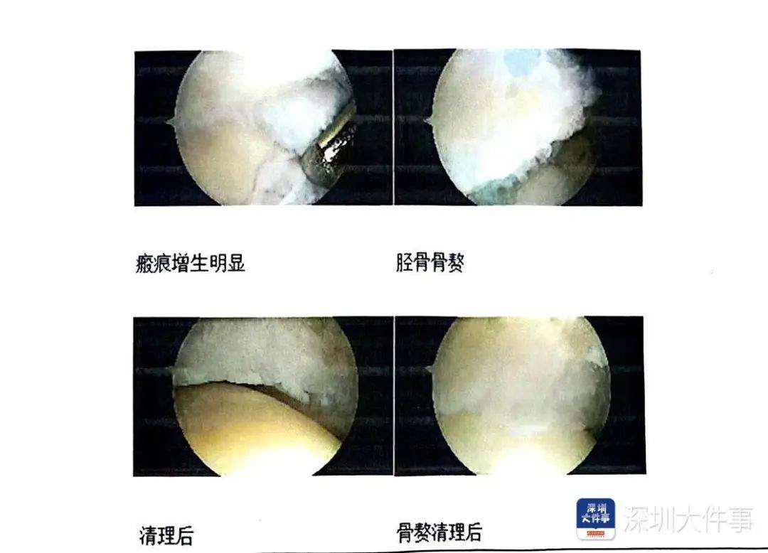 “一走路就痛”！女子脚踝受伤遭漏诊<strong></p>
<p>虚拟币LOL</strong>，治了7年没好！深圳一医院被告上法庭