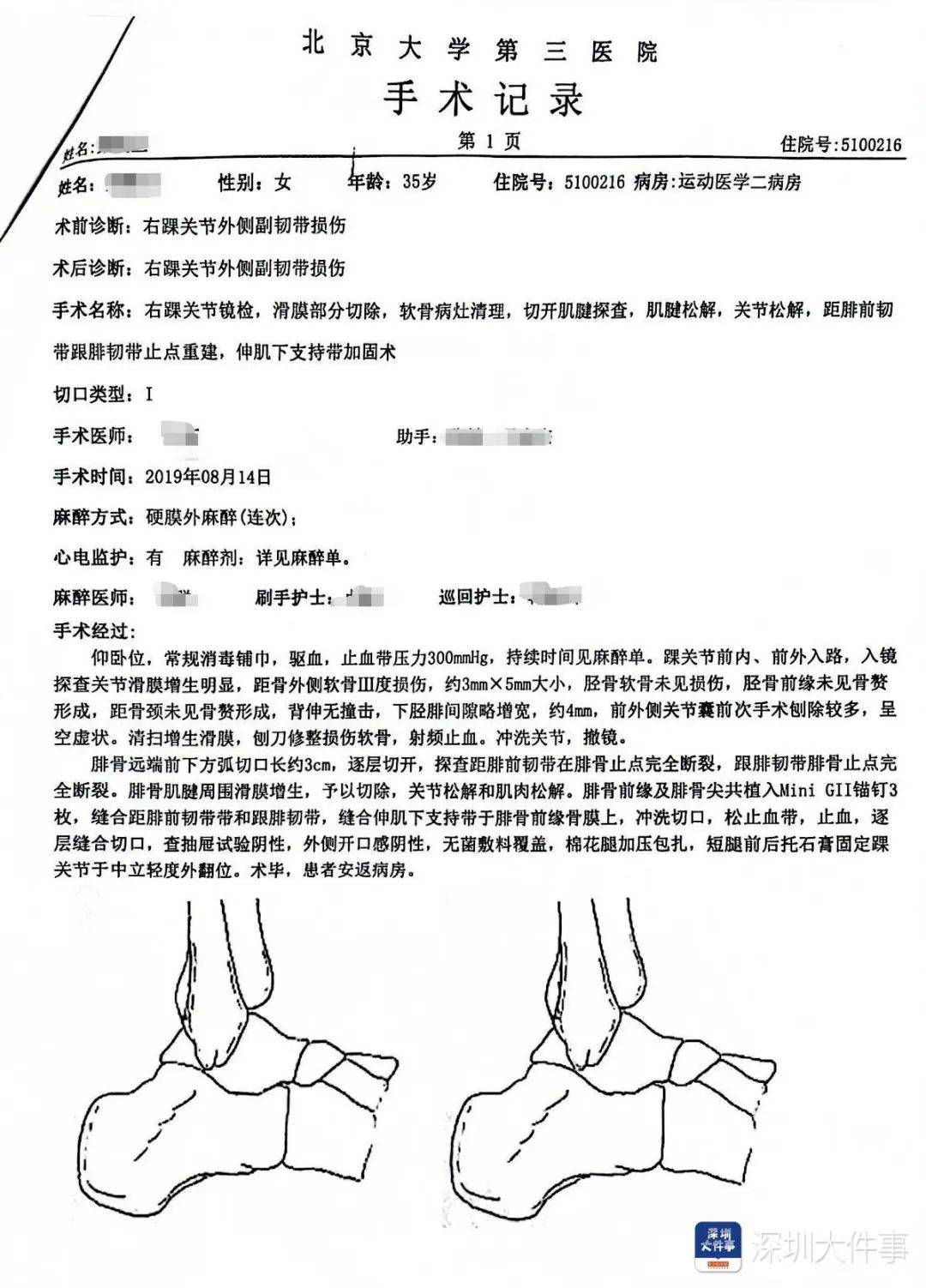 “一走路就痛”！女子脚踝受伤遭漏诊<strong></p>
<p>虚拟币LOL</strong>，治了7年没好！深圳一医院被告上法庭