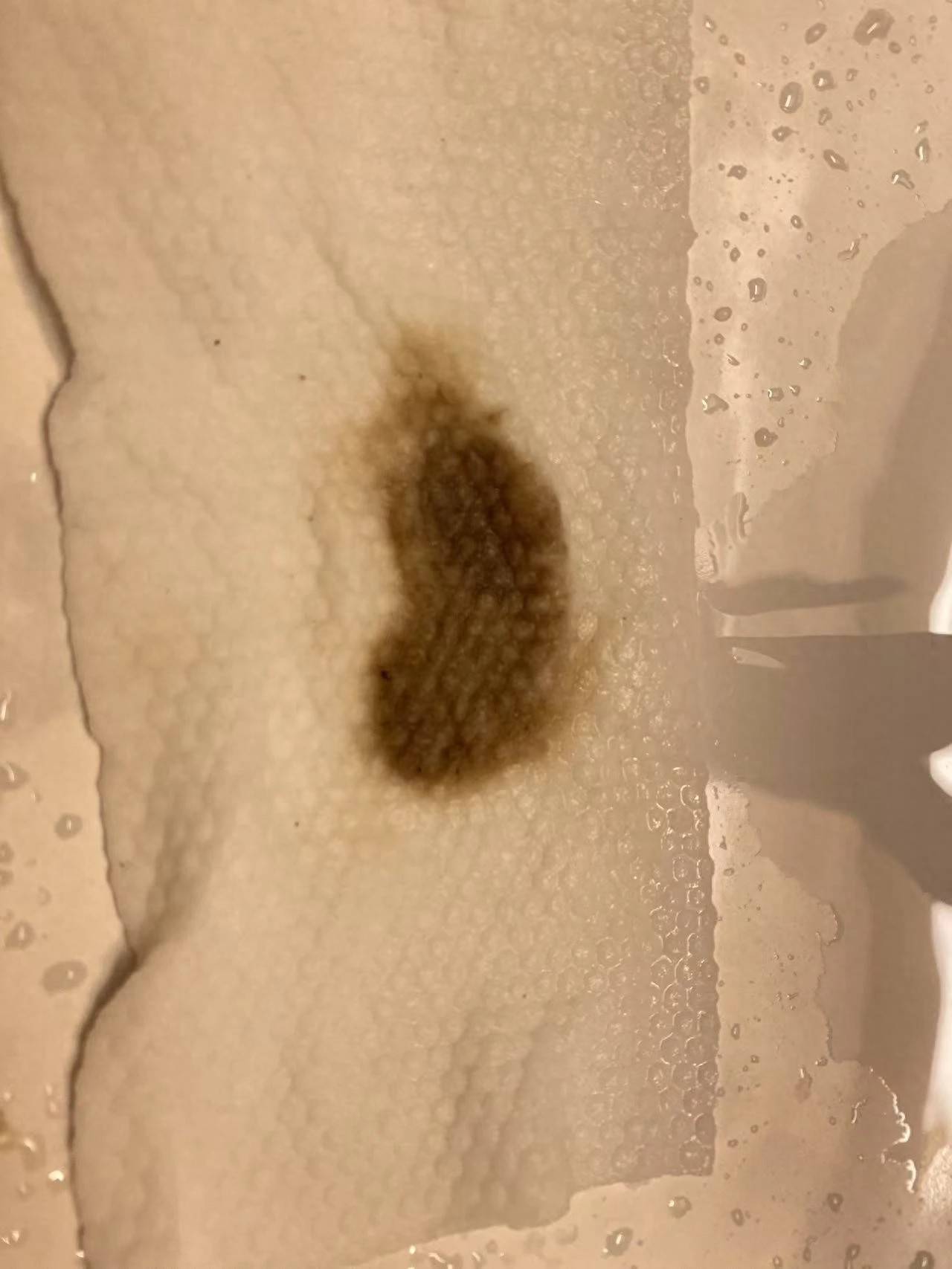 杭州部分小区居民反映自来水发臭<strong></p>
<p>虚拟数字币交易所</strong>,污染源仍不明