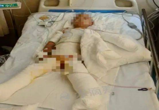 揪心<strong></p>
<p>猴币虚拟</strong>！突发爆炸！很多家庭还在用