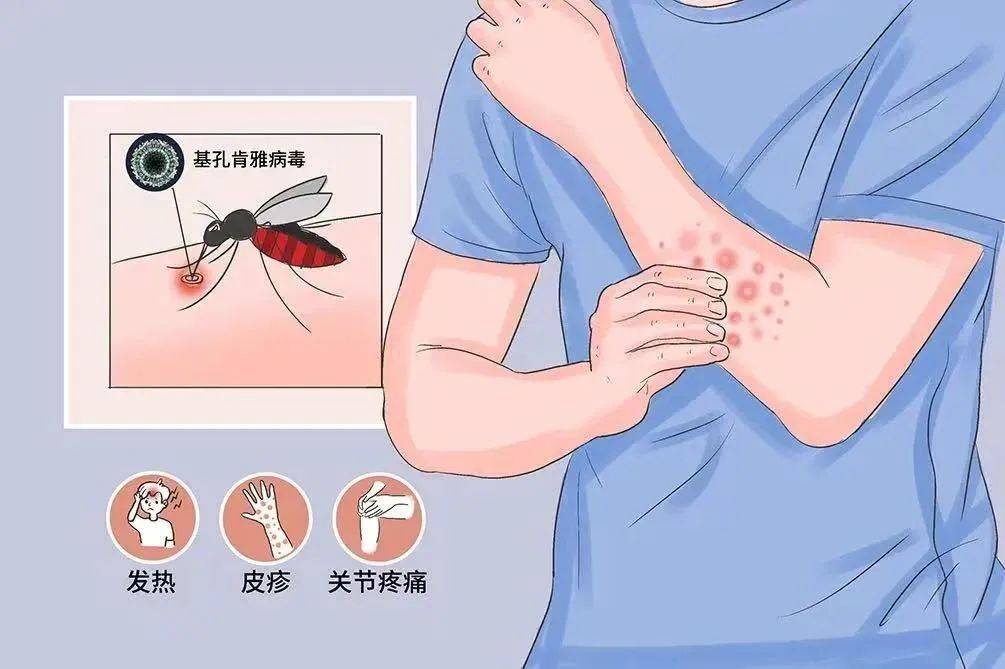 风险增大<strong></p>
<p>MBI虚拟币</strong>！深圳疾控：去这247处要小心！张文宏首次发声