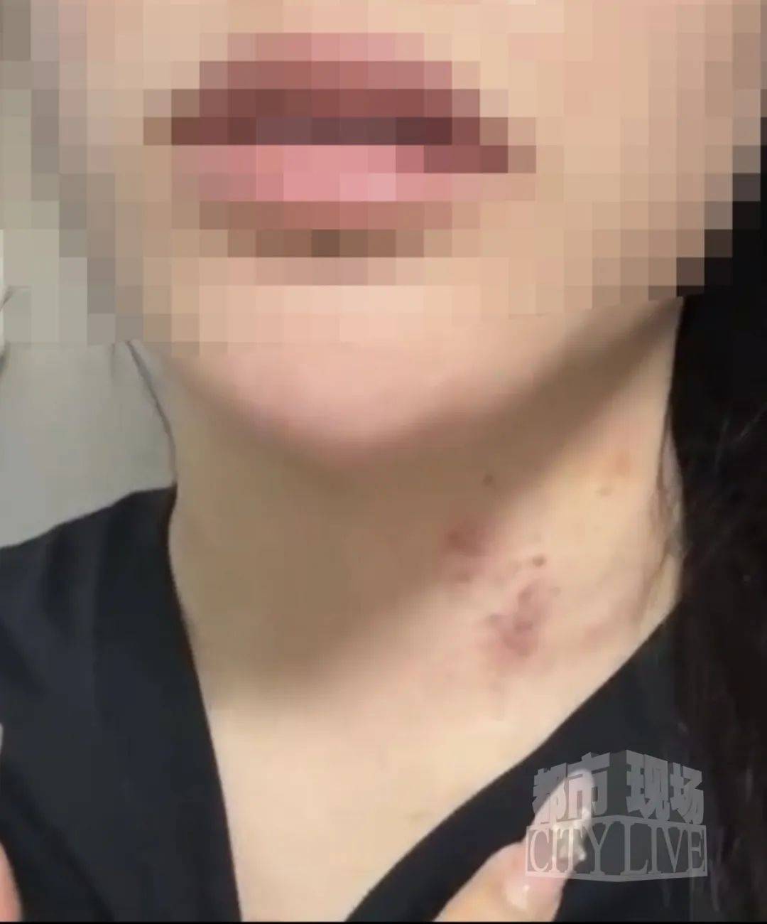 湖南衡阳29岁女子疑被男友施暴后从25楼跳下身亡 男友徐某此前还刺激说：“你放心<strong></p>
<p>迪士尼</strong>，她不会去死的”