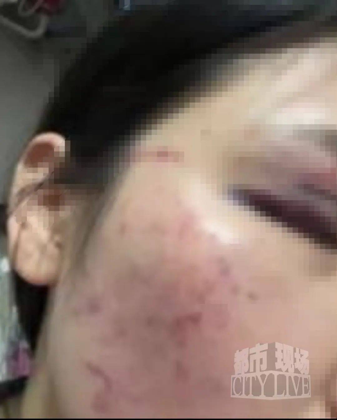 湖南衡阳29岁女子疑被男友施暴后从25楼跳下身亡 男友徐某此前还刺激说：“你放心<strong></p>
<p>迪士尼</strong>，她不会去死的”