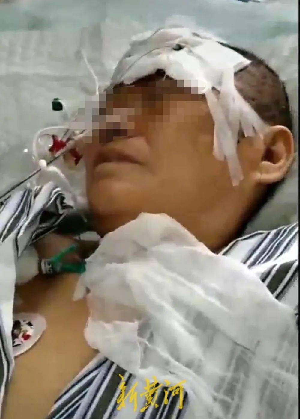 六旬老人遭狩猎者枪击致重伤<strong></p>
<p>利亚德股票</strong>，开枪者两次逃离现场，事发4小时后冒充“好心人”施救，家属：耽误了最佳救治时间