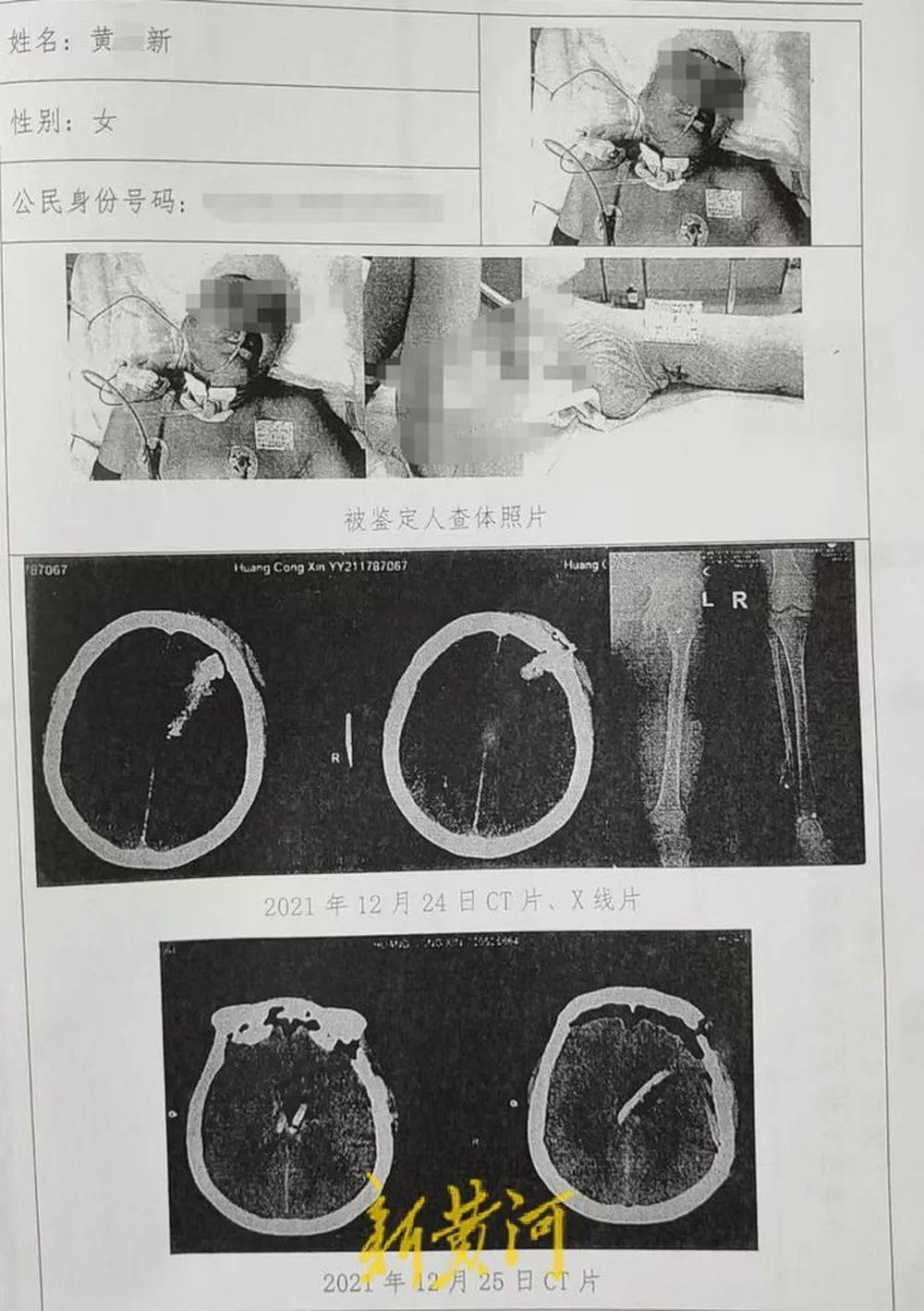 六旬老人遭狩猎者枪击致重伤<strong></p>
<p>利亚德股票</strong>，开枪者两次逃离现场，事发4小时后冒充“好心人”施救，家属：耽误了最佳救治时间