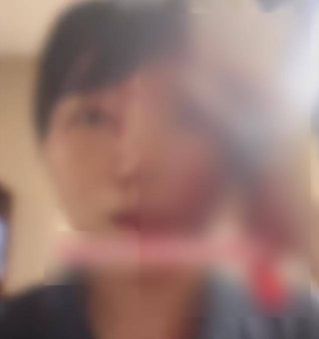 缝了20多针！女子称被不知名男同事砸头毁容<strong></p>
<p>中国中免股票</strong>，警方介入