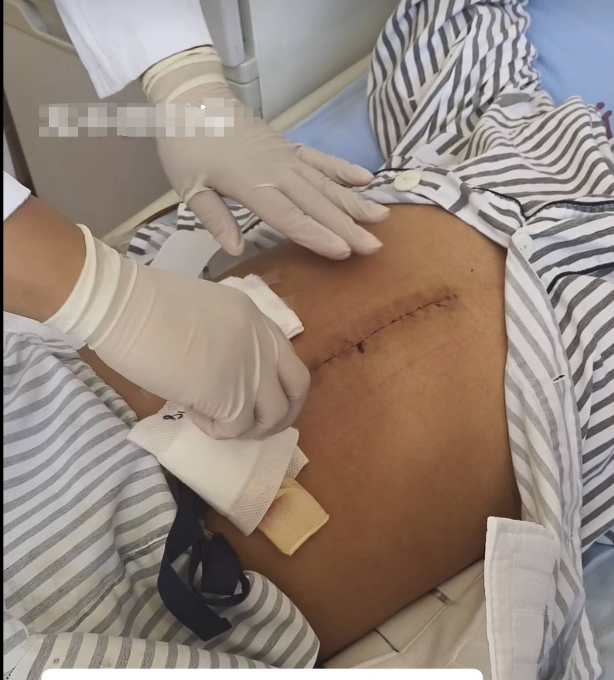 奶奶在哭<strong></p>
<p>深康佳a股票</strong>,宝宝在笑!40天女婴重病,00后父亲割肝救女,术后这一幕让网友泪奔