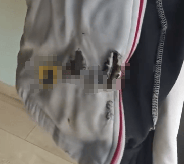 高中生散步时校服突发自燃<strong></p>
<p>亿纬锂能股票</strong>？原是165元网购的“宝”在惹祸→