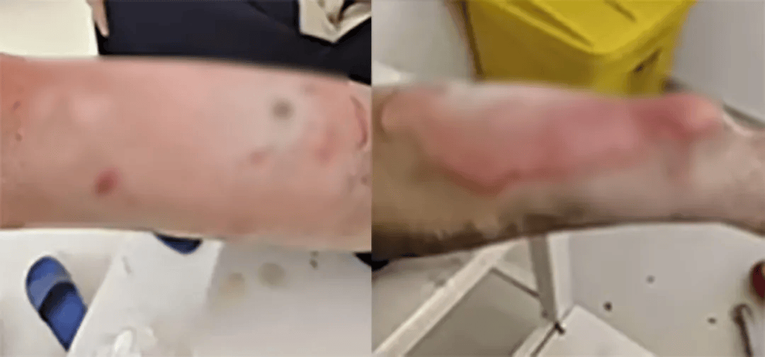 高中生散步时校服突发自燃<strong></p>
<p>亿纬锂能股票</strong>？原是165元网购的“宝”在惹祸→