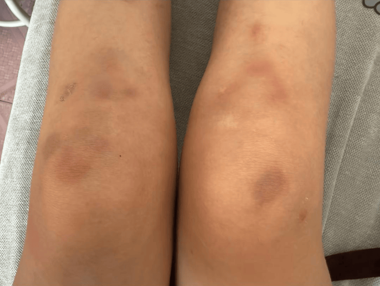 女子自称因工资问题被老板锁办公室里打 警方：双方已到派出所<strong></p>
<p>北京银行股票</strong>，是否打人还在调查