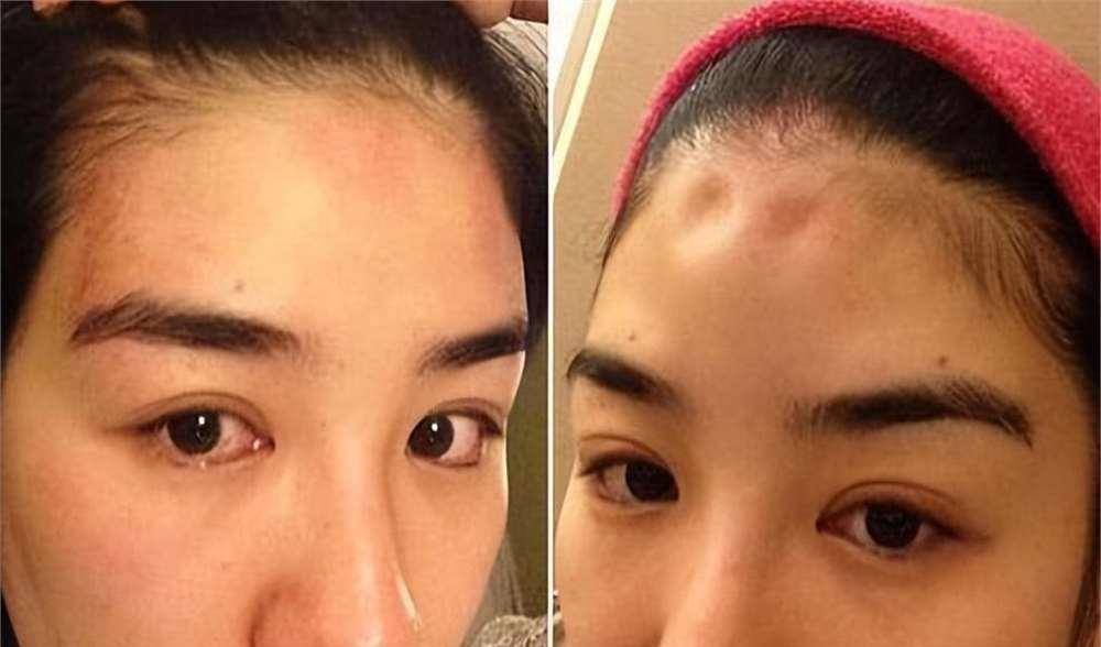 罗霖被家暴17年<strong></p>
<p>北京银行股票</strong>，蓝洁瑛遭性侵暴力还被围观！女明星的暴力事件还有很多