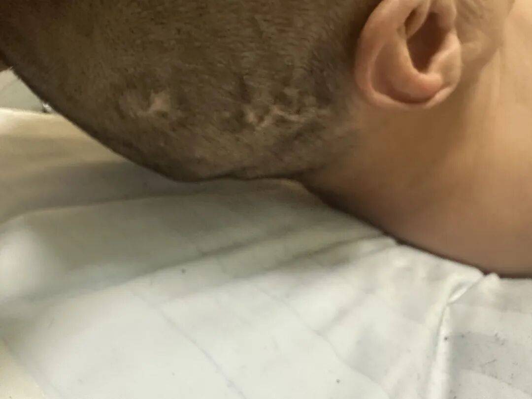 4名游客景区内遭马蜂袭击<strong></p>
<p>宁波银行股票</strong>,旅游度假区:是森林公园不卖门票,蜇伤先就医后提供证据投诉