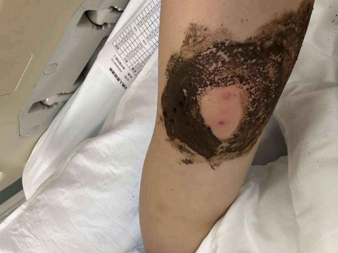 4名游客景区内遭马蜂袭击<strong></p>
<p>宁波银行股票</strong>,旅游度假区:是森林公园不卖门票,蜇伤先就医后提供证据投诉