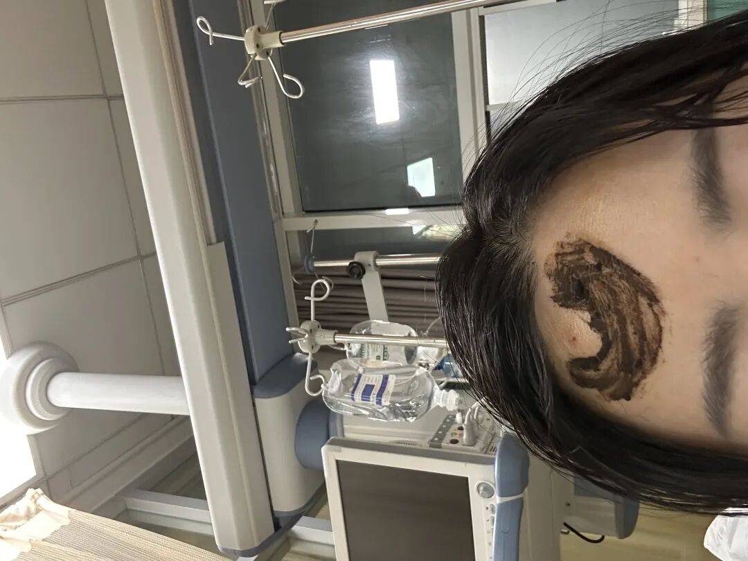 4名游客景区内遭马蜂袭击<strong></p>
<p>宁波银行股票</strong>,旅游度假区:是森林公园不卖门票,蜇伤先就医后提供证据投诉