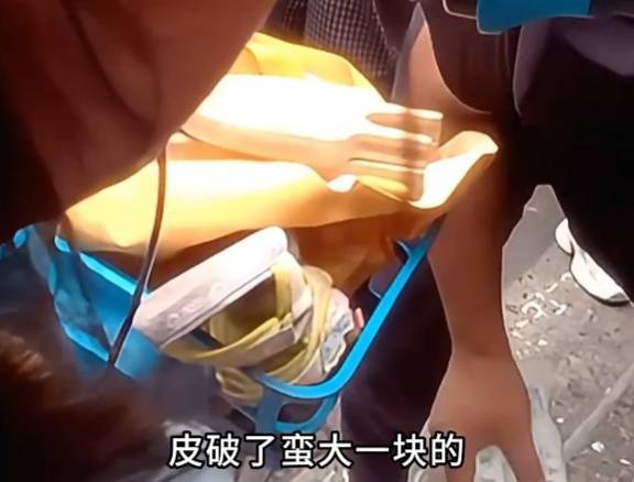 看着都疼<strong></p>
<p>华友钴业股票</strong>!上海街头一男子突然求助:10岁女儿被死死卡住!这个行为太危险→