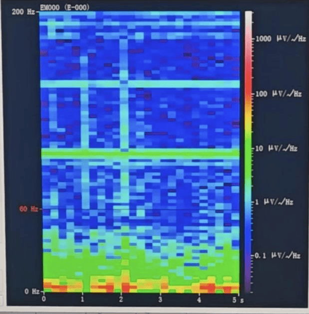 山西首例<strong></p>
<p>生益科技股票</strong>！山西省人民医院成功实施脑机接口辅助功能区脑肿瘤切除手术