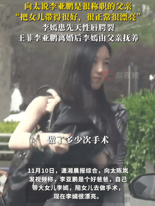 向太说李亚鹏是个好爸爸：<strong></p>
<p>久其软件股票</strong>他自己带大女儿李嫣还陪她做手术