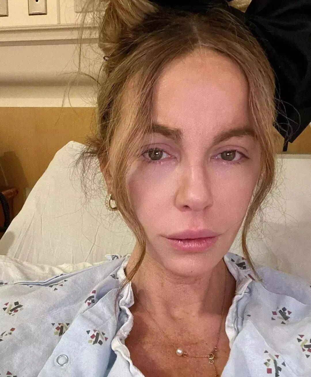 最美吸血鬼如今瘦成骷髅<strong></p>
<p>久其软件股票</strong>?《珍珠港》女主究竟怎么了?