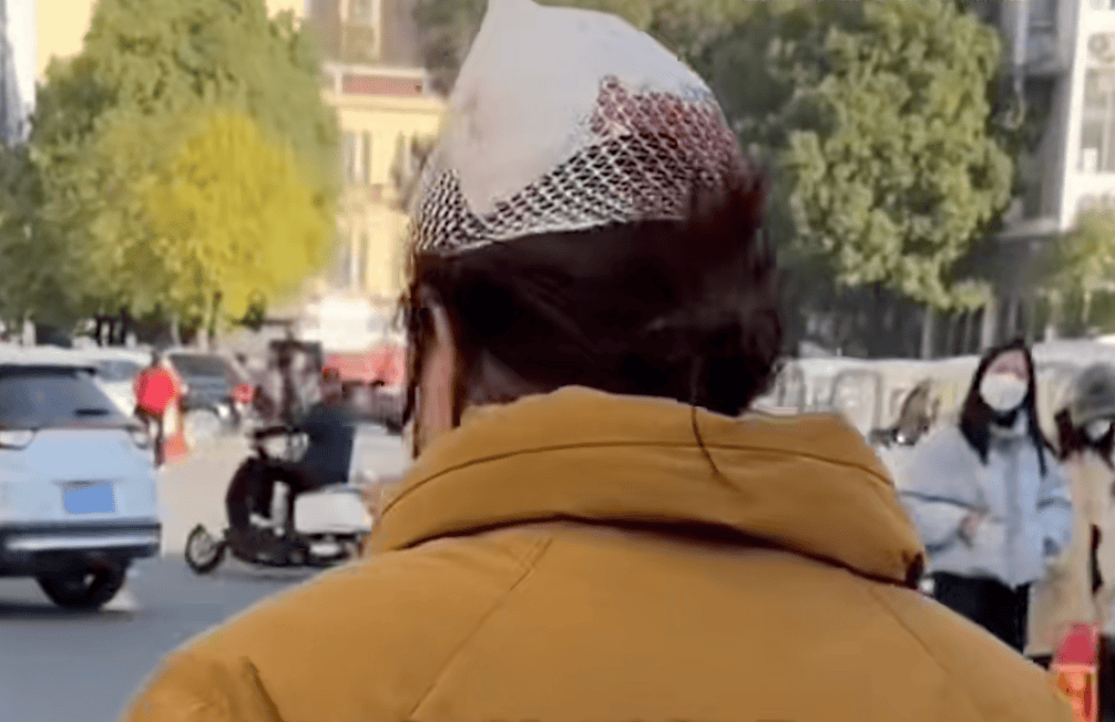 后脑勺缝了9针！女生这些场景戴它<strong></p>
<p>中国医药股票</strong>，等于顶了个“凶器”？