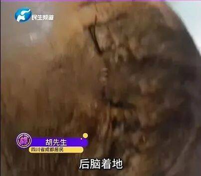 后脑勺缝了9针！女生这些场景戴它<strong></p>
<p>中国医药股票</strong>，等于顶了个“凶器”？