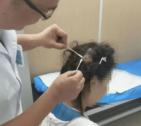 后脑勺缝了9针！女生这些场景戴它<strong></p>
<p>中国医药股票</strong>，等于顶了个“凶器”？