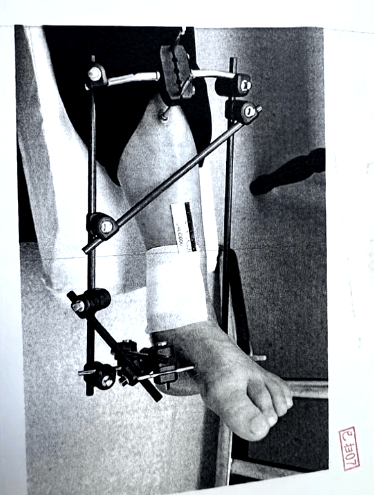 男子停车场随地小便被制止<strong></p>
<p>宜宾纸业股票</strong>，恼羞成怒飞踹管理员致自己骨折，索赔18万余元，法院判了